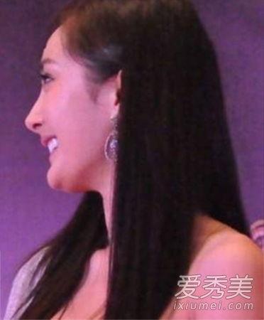 明星假下巴,科技美容的极致追求