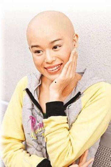 光头明星有些谁